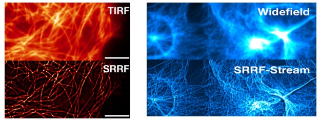   SRRF